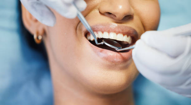 Best Tooth Pain Emergency Relief  in Langston, OK