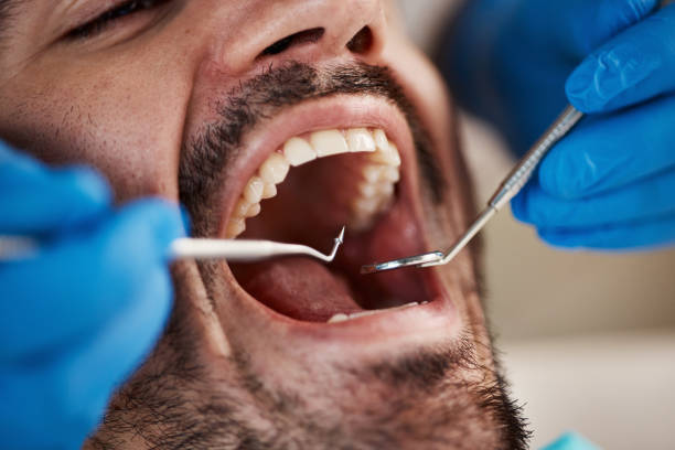 Best Emergency Tooth Extraction  in Langston, OK